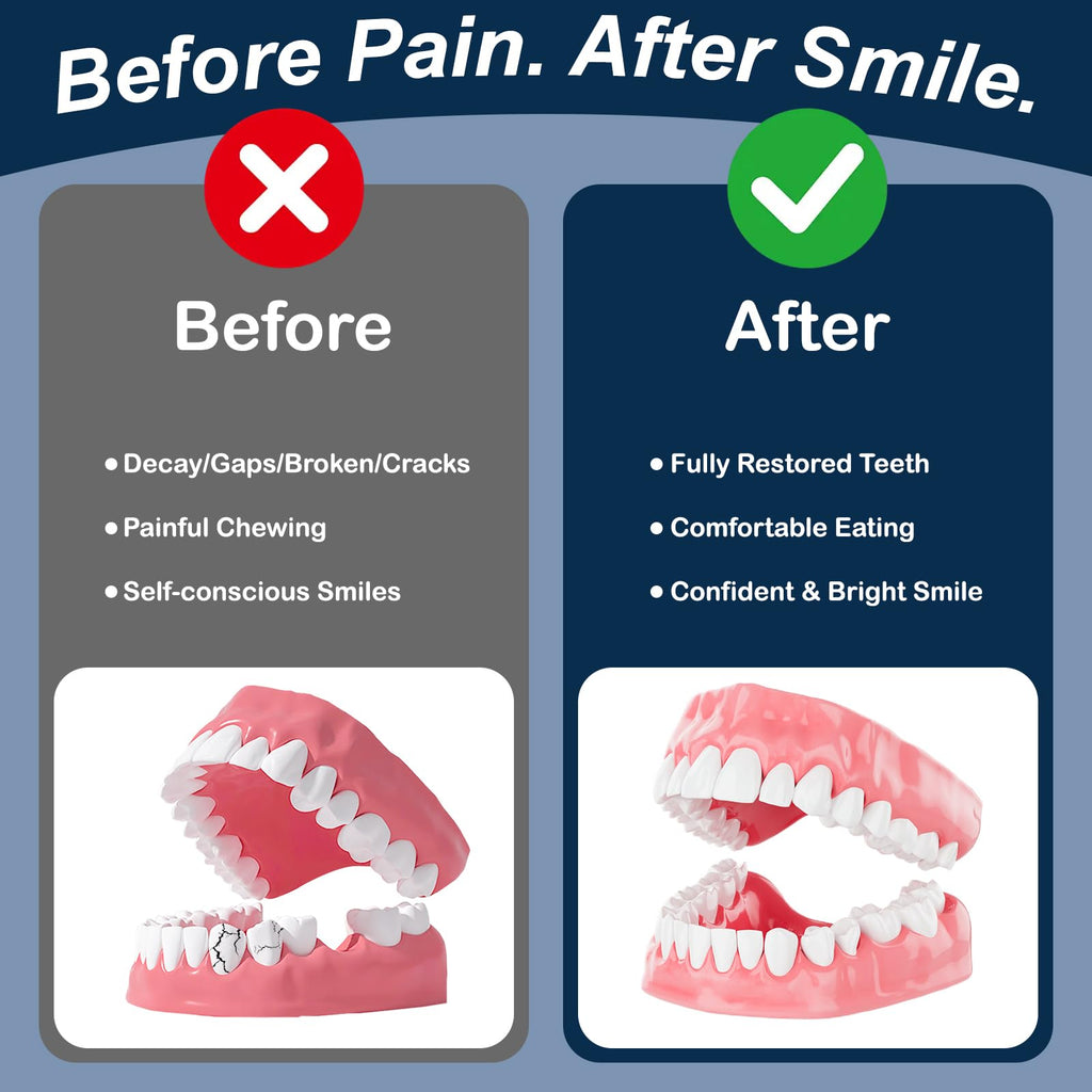 Denture Repair Glue 1oz Fast-Setting Adhesive D123
